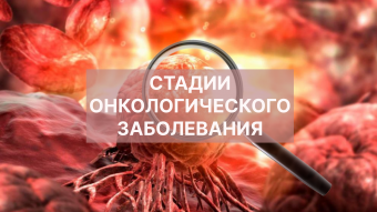 Развитие онкологических заболеваний Развитие онкологических заболеваний